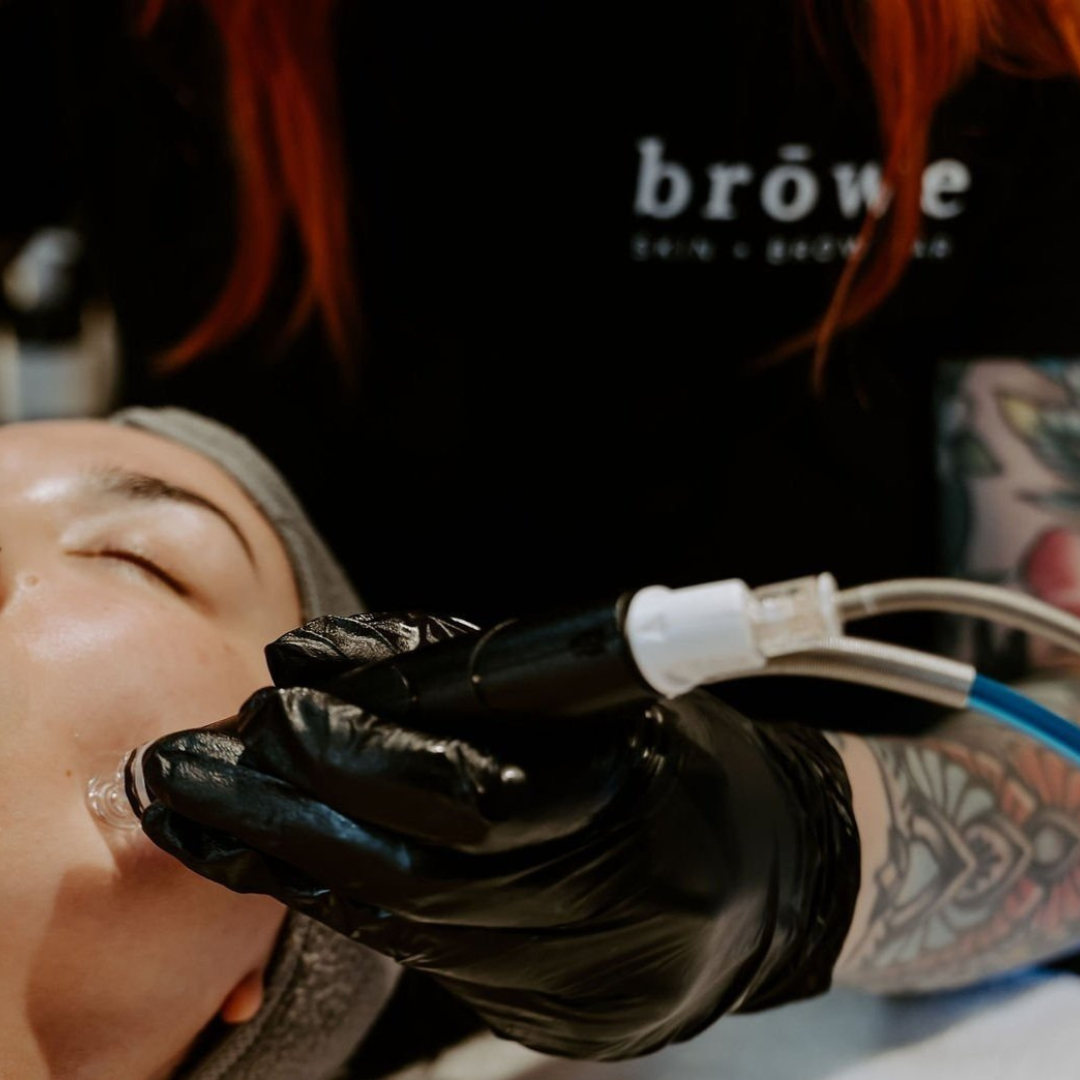 Issue 76 | Hydrafacial 101