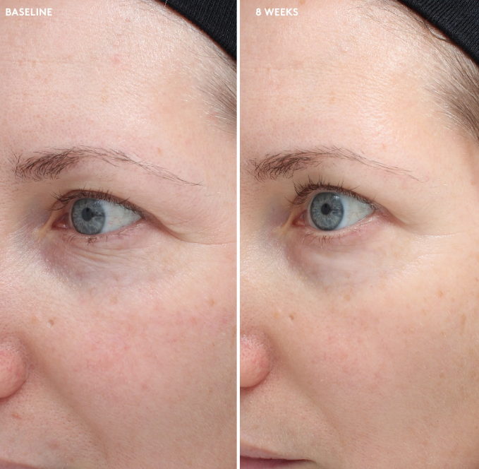 Total Eye® Firm & Repair Cream