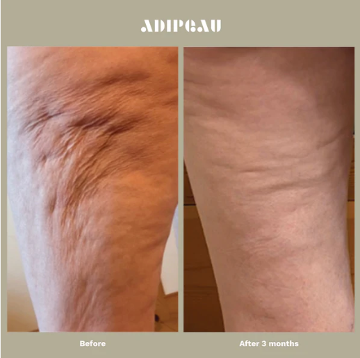 Adipeau Strength Gel