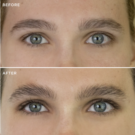 Before and after comparison of eyebrow grooming on a person with blue eyes.