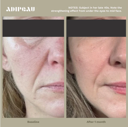 Adipeau Strength Gel