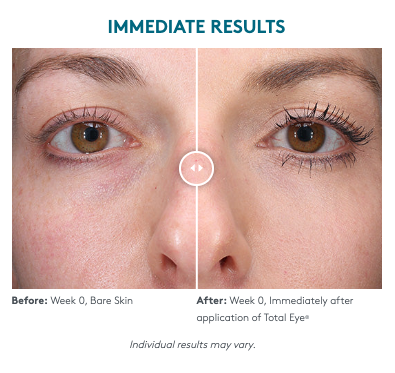 Total Eye® 3-In-1 Renewal Therapy SPF 35