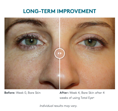 Total Eye® 3-In-1 Renewal Therapy SPF 35