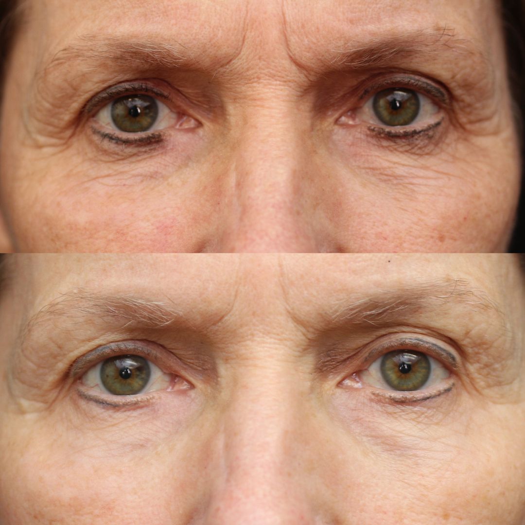 Total Eye® Firm & Repair Cream