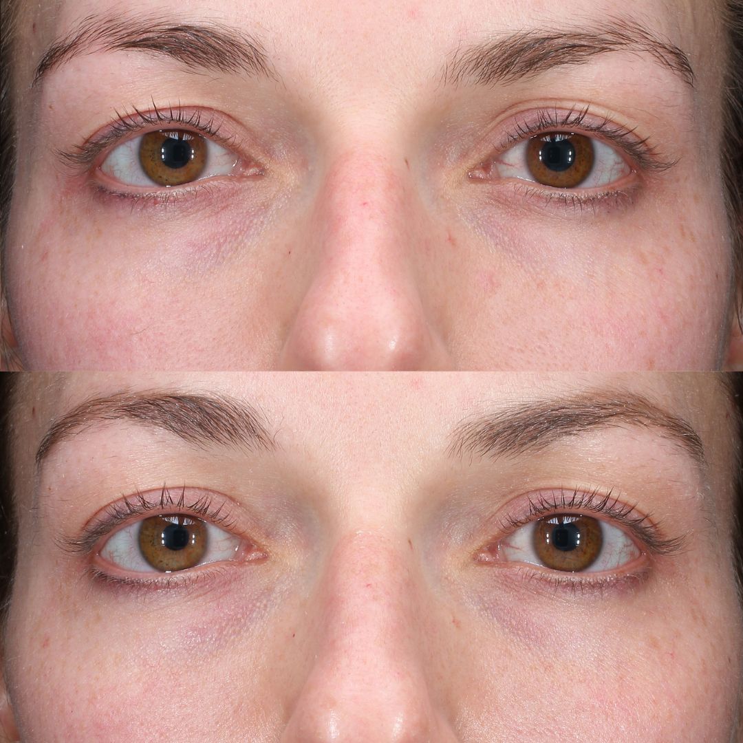 Total Eye® Firm & Repair Cream